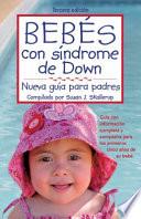 Bebés con síndrome de down
