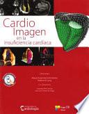 Cardio Imagen En La Insuficiencia Cardiaca