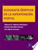 Ecografía Doppler en la hipertensión portal
