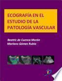 Ecografía en el estudio de la patología vascular