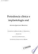 Periodoncia clínica e implantación oral