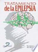 Tratamiento de la epilepsia