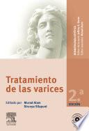 Tratamiento de las varices 2 ed. © 2011